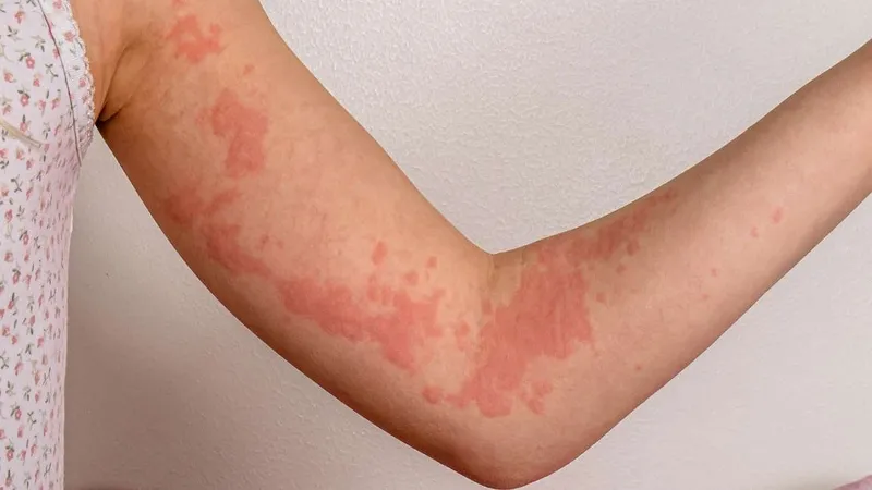 Rắn hổ hành săn mồi trong môi trường ẩm ven ruộng