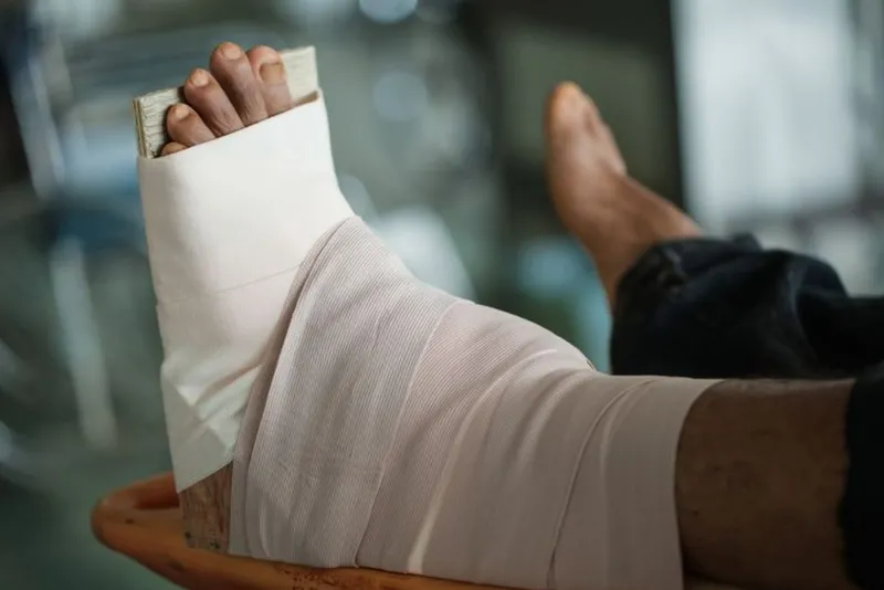 Băng ép bất động và nẹp chi giúp hạn chế phát tán nọc rắn